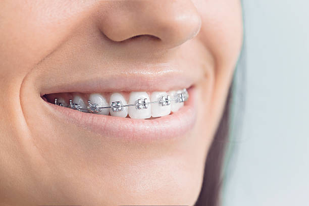 Best Invisalign and Clear Aligners  in Reform, AL